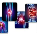What is Joint Pain?