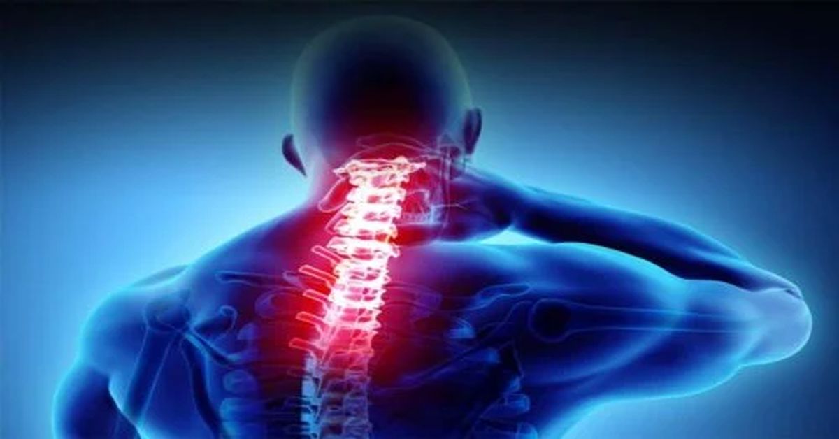 boyun fitigi tedavisi 1 Boyun Fıtığı Tedavisi