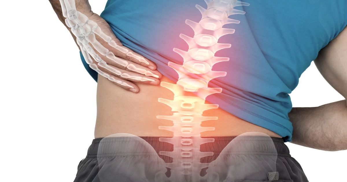 Schmerzen im unteren Rücken Schmerzen im unteren Rücken