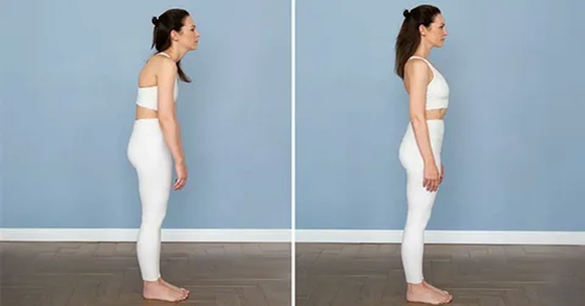 postur bozuklugu 2 2 Postür Bozukluğu