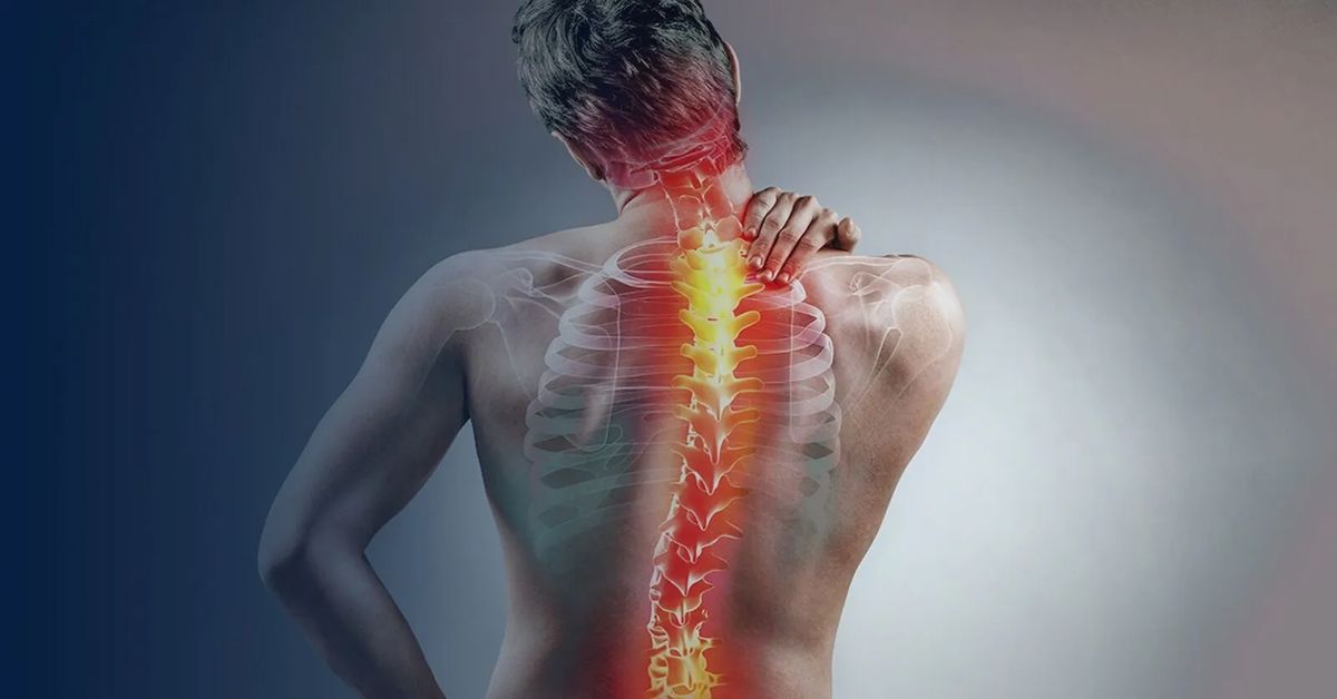 postural disorder Postural Disorder