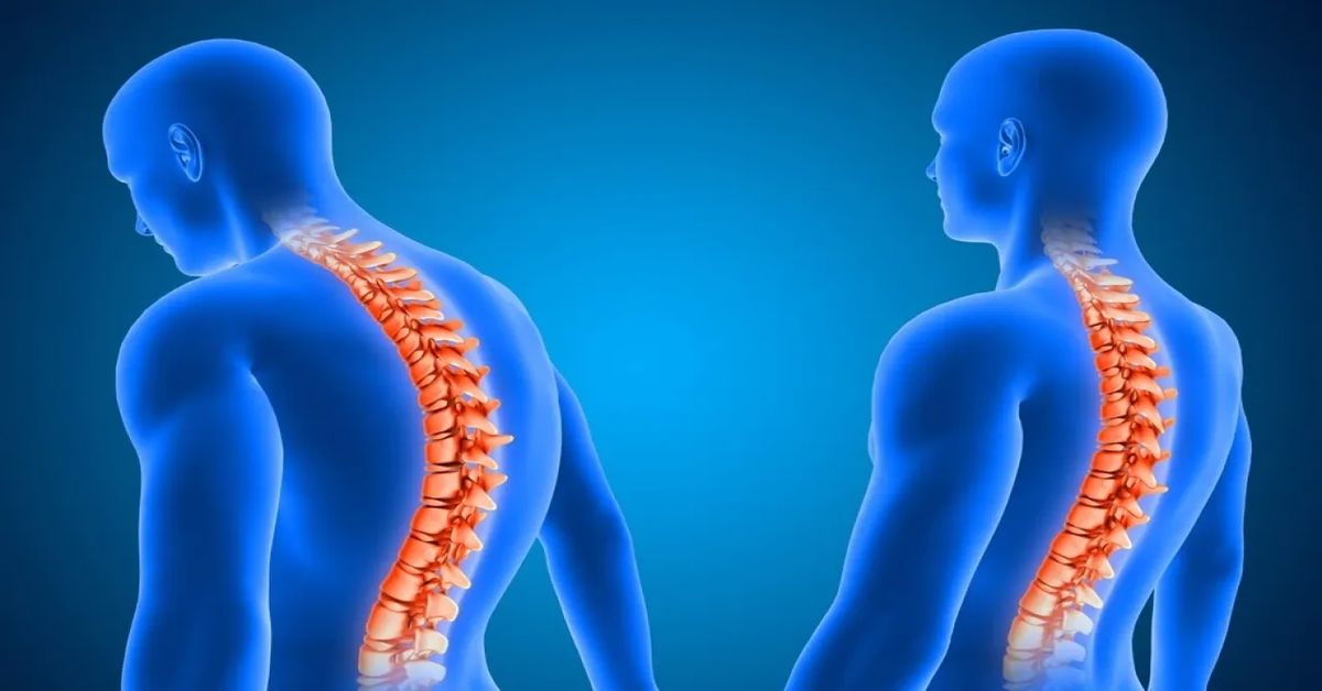 postural disorder Postural Disorder