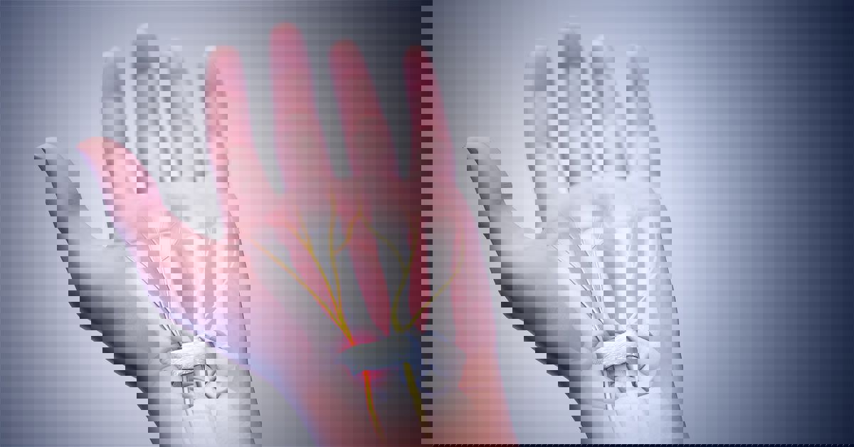 sinir zedelenmesi 1 1 Nervenschäden