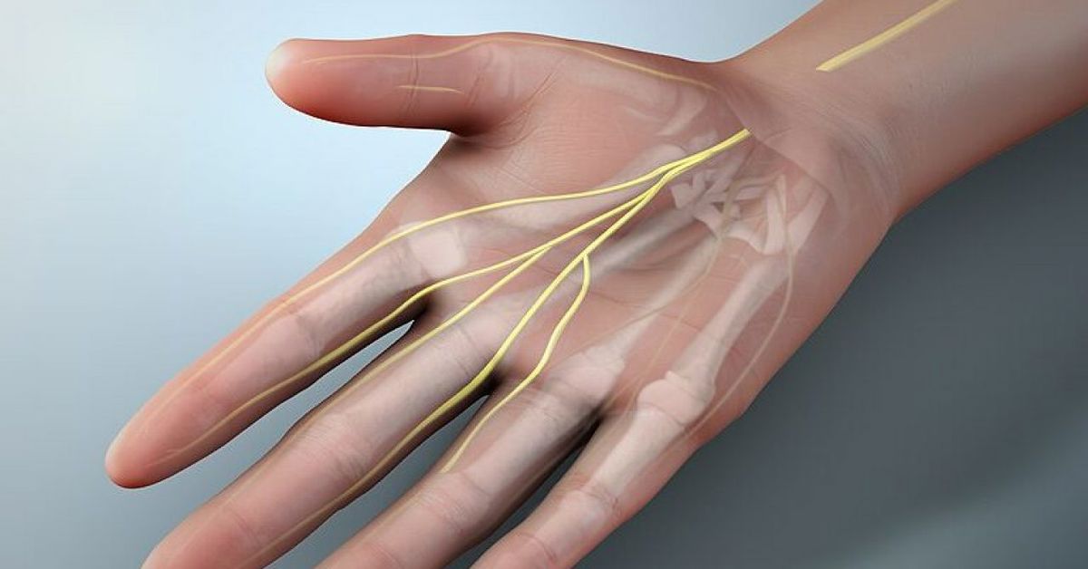 sinir zedelenmesi 2 Nervenschäden