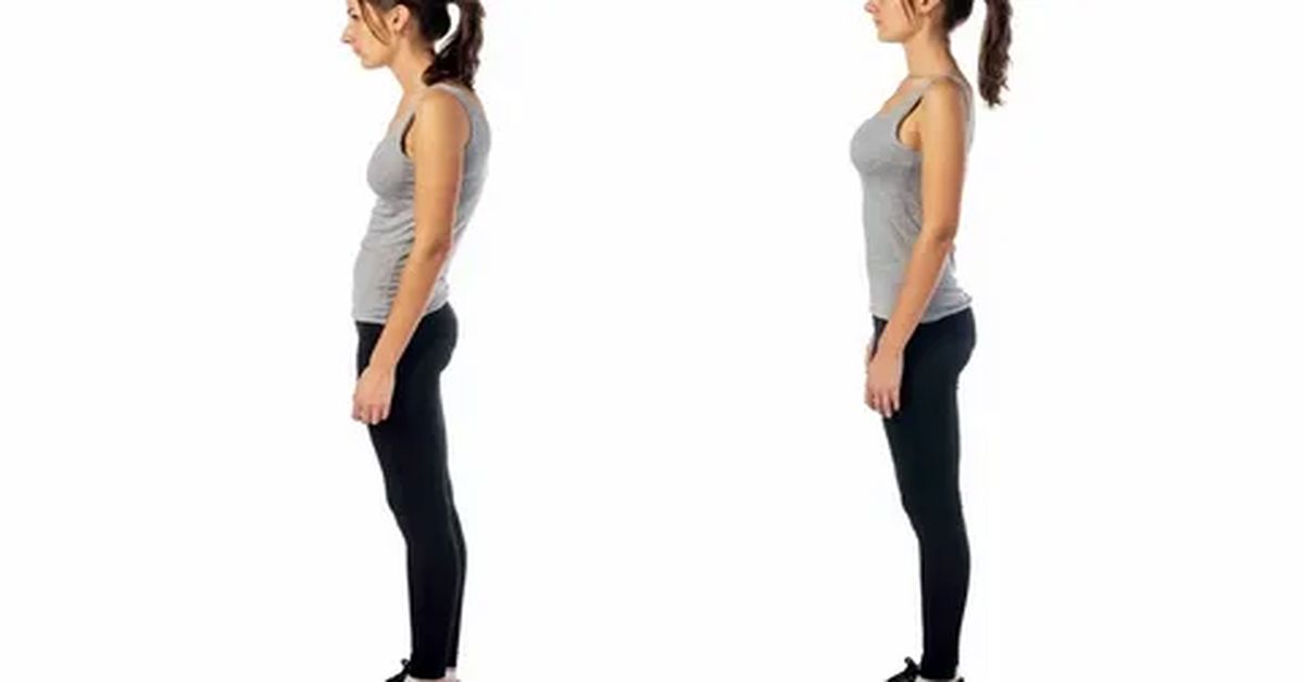 Duruş Bozukluğu Tedavisi