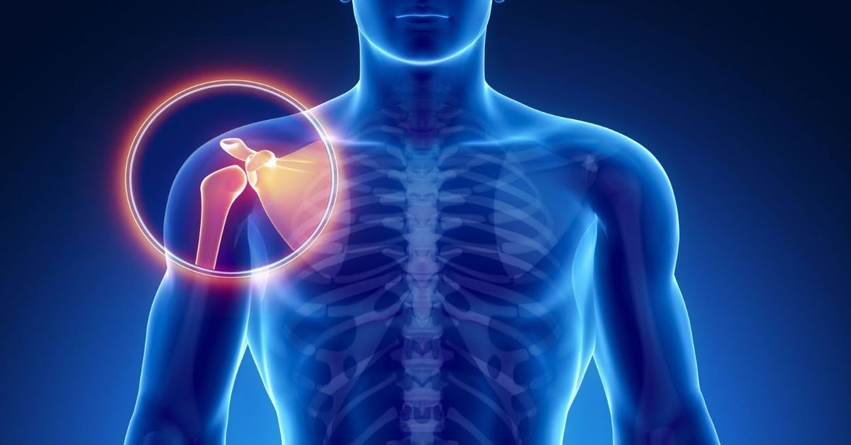 Eklem Çıkığı Tedavisi