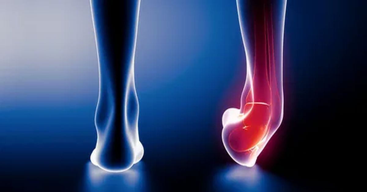 Eklem Burkulması Nedir?