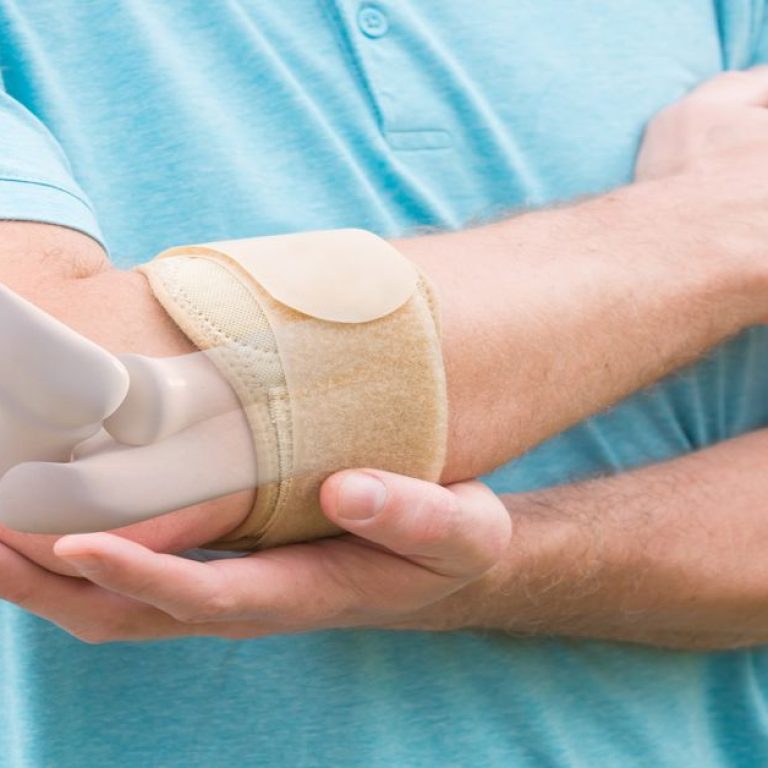 Dirsek Çıkığı Tedavisi