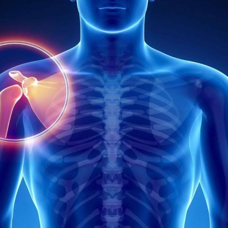 Eklem Çıkığı Tedavisi