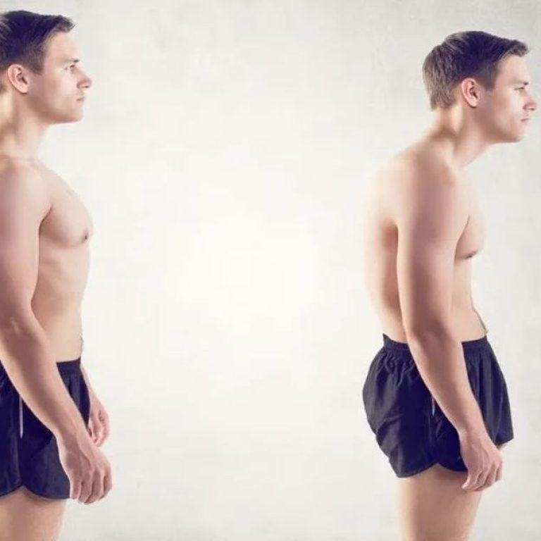 Posture Disorder